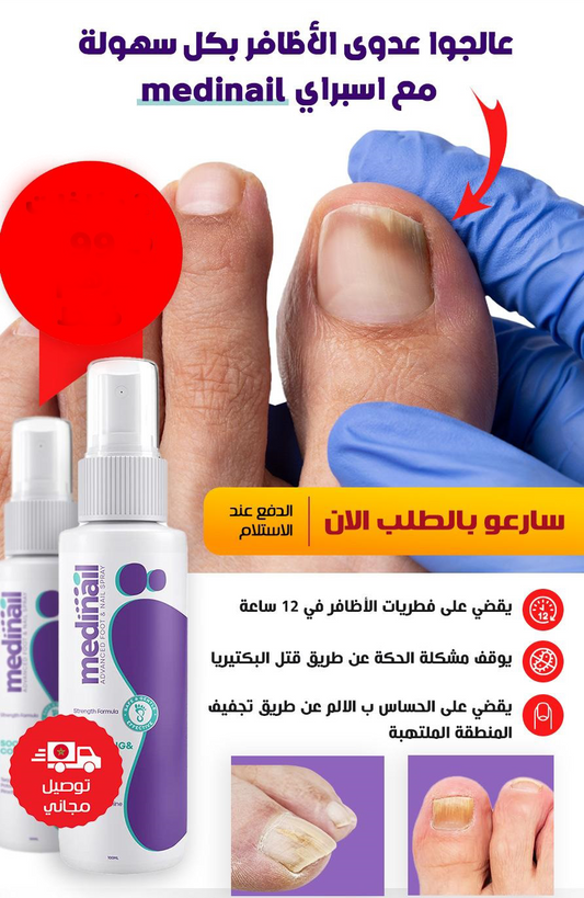 بخاخ علاج الاظافر الأصلي (احذر المقلد )
